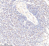 Anti-PYK2/PTK2B Antibody Picoband® Boster Bio