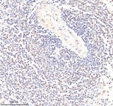 Anti-PYK2/PTK2B Antibody Picoband® Boster Bio
