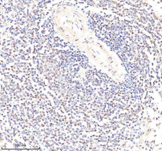 Anti-PYK2/PTK2B Antibody Picoband® Boster Bio