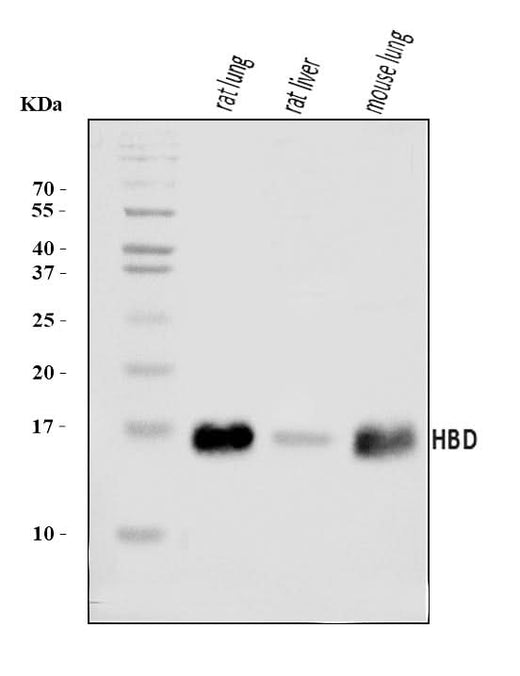 Anti-HBD Antibody Picoband® Boster Bio