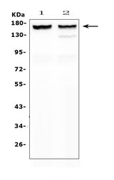 Anti-MYBPC3 Antibody Picoband® Boster Bio