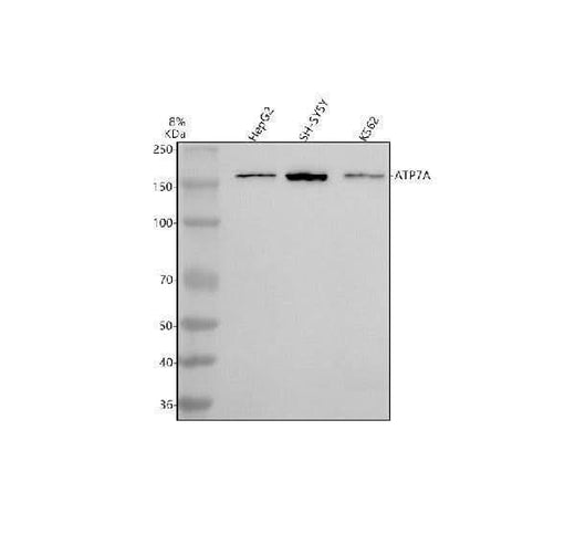 Anti-ATP7A Antibody Picoband® Boster Bio