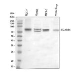 Anti-Scavenging Receptor SR-BI/SCARB1 Antibody Picoband® Boster Bio