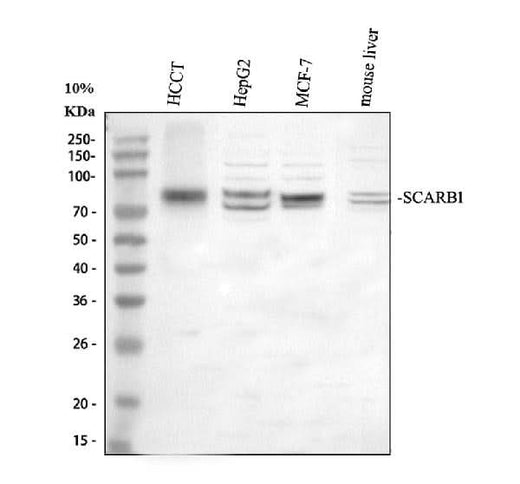 Anti-Scavenging Receptor SR-BI/SCARB1 Antibody Picoband® Boster Bio