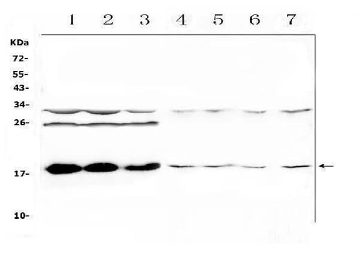 Anti-TSLP Antibody Picoband® Boster Bio