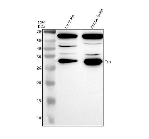 Anti-Trh Antibody Picoband® Boster Bio