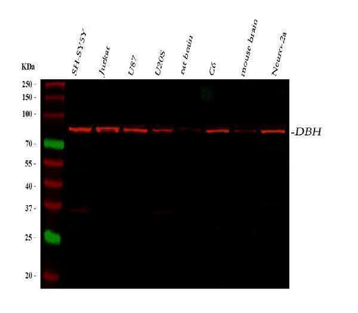 Anti-Dopamine beta Hydroxylase/DBH Antibody Picoband® Boster Bio