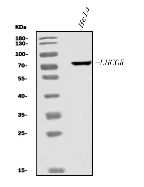 Anti-hCG receptor/LHR/LHCGR Antibody Picoband® Boster Bio