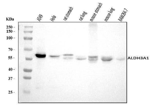 Anti-ALDH3A1 Antibody Picoband® Boster Bio