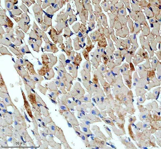 Anti-SLN Antibody Boster Bio