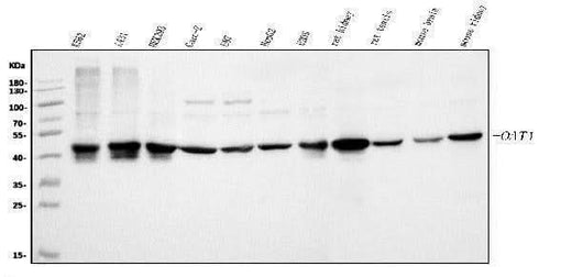 Anti-ornithine aminotransferase/OAT Antibody Picoband® Boster Bio