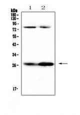 Anti-Factor D/Cfd Antibody Picoband® Boster Bio