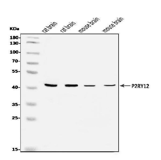 Anti-P2Y12/P2ry12 Antibody Picoband® Boster Bio