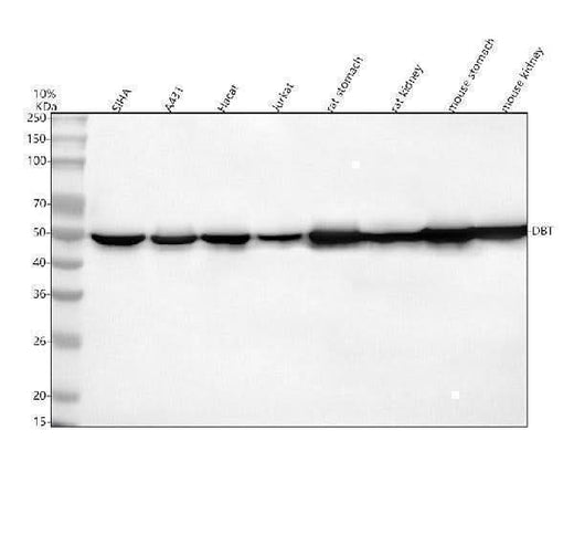 Anti-DBT Antibody Picoband® Boster Bio