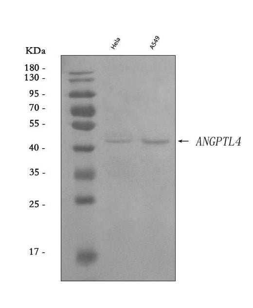 Anti-Angiopoietin-like 4/ANGPTL4 Antibody Picoband® Boster Bio