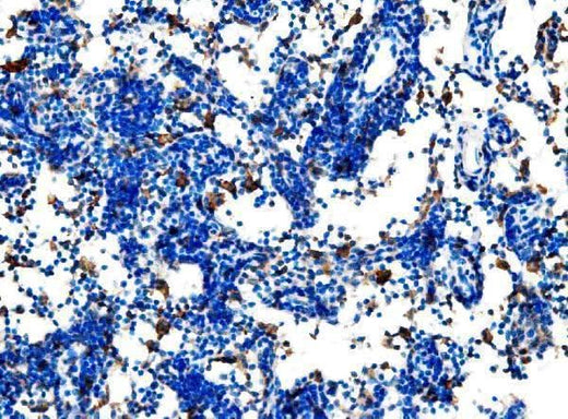 Anti-Cd27 Antibody Boster Bio