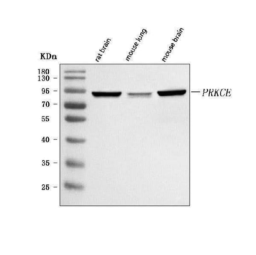 Anti-PRKCE Antibody Picoband® Boster Bio