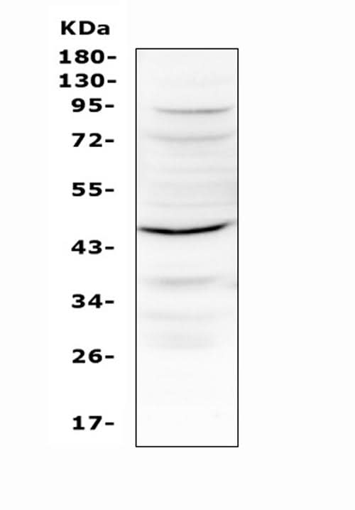 Anti-IL12B Antibody Picoband® Boster Bio