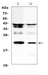 Anti-IL11 Antibody Picoband® Boster Bio