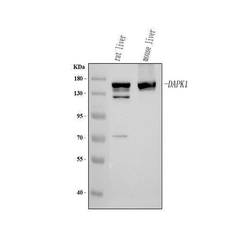 Anti-DAPK1 Antibody Picoband® Boster Bio