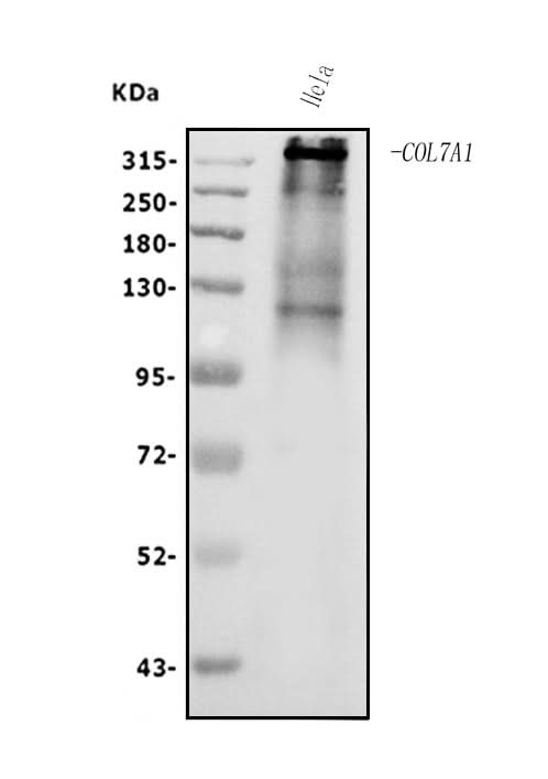 Anti-Collagen VII/COL7A1 Antibody Picoband® Boster Bio