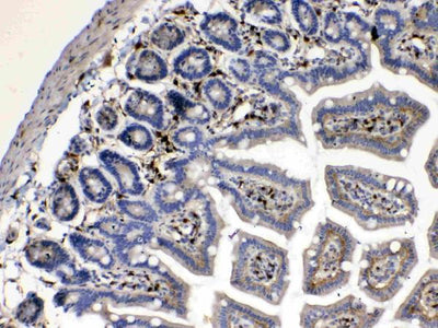 Anti-Cytoglobin/CYGB Antibody Picoband® Boster Bio