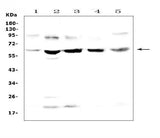 Anti-Steroid sulfatase/STS Antibody Picoband® Boster Bio
