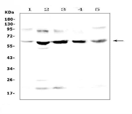 Anti-Steroid sulfatase/STS Antibody Picoband® Boster Bio
