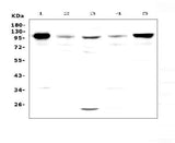 Anti-VCAM1 Antibody Picoband® Boster Bio