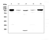Anti-VCAM1 Antibody Picoband® Boster Bio