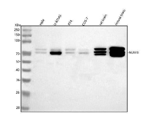 Anti-NUMB Antibody Picoband® Boster Bio