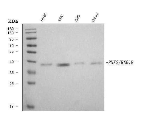 Anti-RING2/RING1B/RNF2 Antibody Picoband® Boster Bio