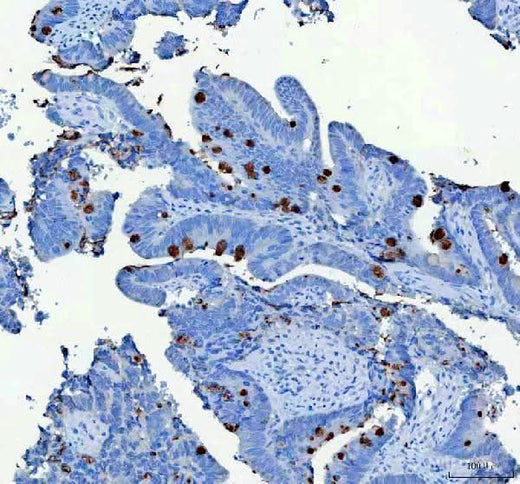 Anti-MUC2 Antibody Boster Bio