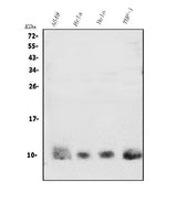 Anti-S100A4 Antibody Picoband® Boster Bio