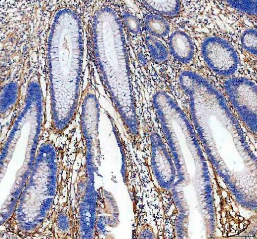 Anti-BIGH3/TGFBI Antibody Picoband® Boster Bio