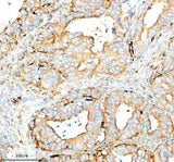 Anti-SERPING1/C1 Antibody Picoband® Boster Bio