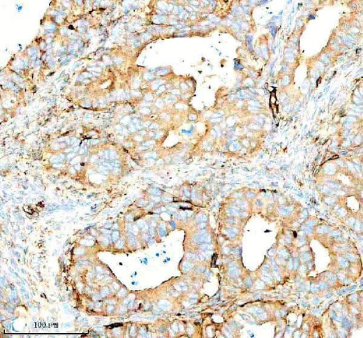 Anti-SERPING1/C1 Antibody Picoband® Boster Bio