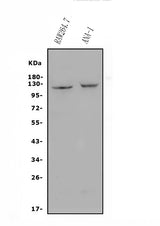Anti-CD30/TNFRSF8 Antibody Picoband® Boster Bio