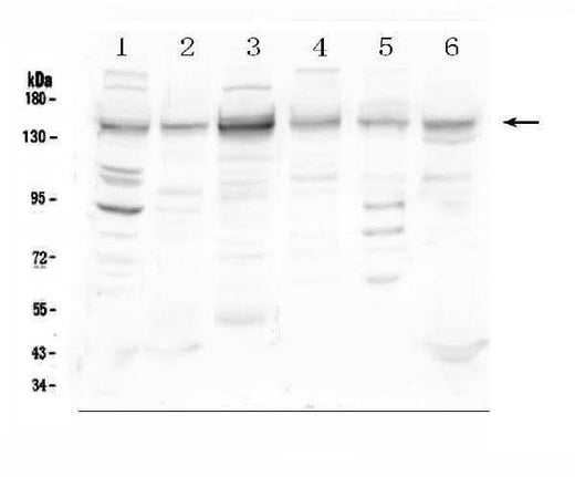 Anti-HDAC5 Antibody Picoband® Boster Bio