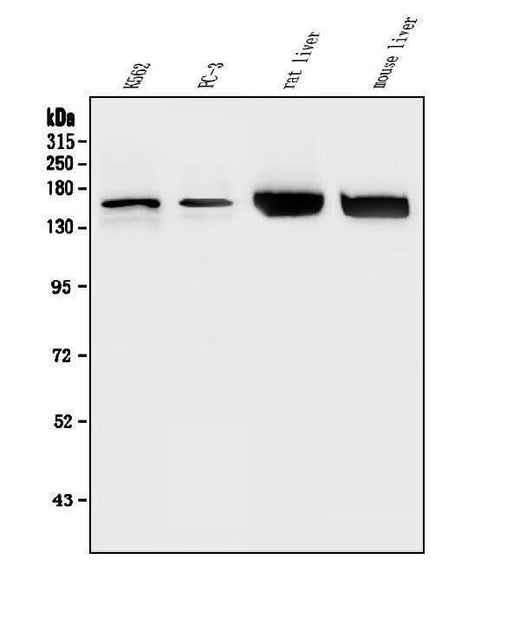 Anti-HDAC5 Antibody Picoband® Boster Bio