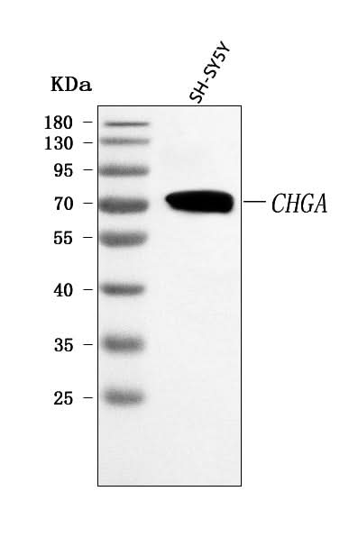 Anti-Chromogranin A/CHGA Antibody Picoband® Boster Bio