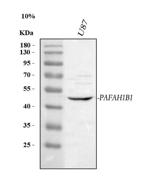 Anti-LIS1/PAFAH1B1 Antibody Picoband® Boster Bio