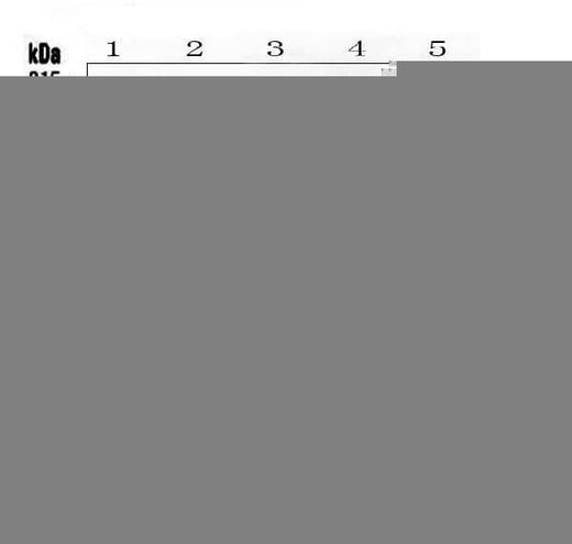 Anti-TIE2/TEK Antibody Picoband® Boster Bio