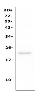 Anti-TAPA1/CD81 Antibody Picoband® Boster Bio