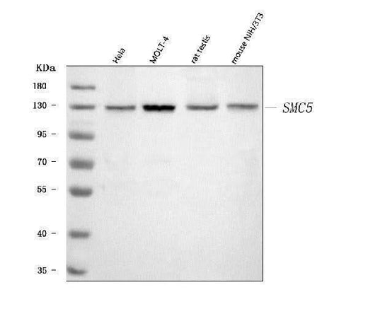 Anti-SMC5 Antibody Picoband® Boster Bio