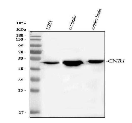Anti-Cannabinoid receptor 1/CNR1 Antibody Picoband® Boster Bio