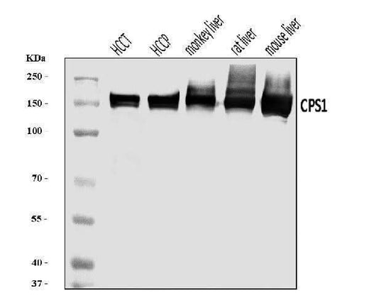 Anti-CPS1 Antibody Picoband® Boster Bio