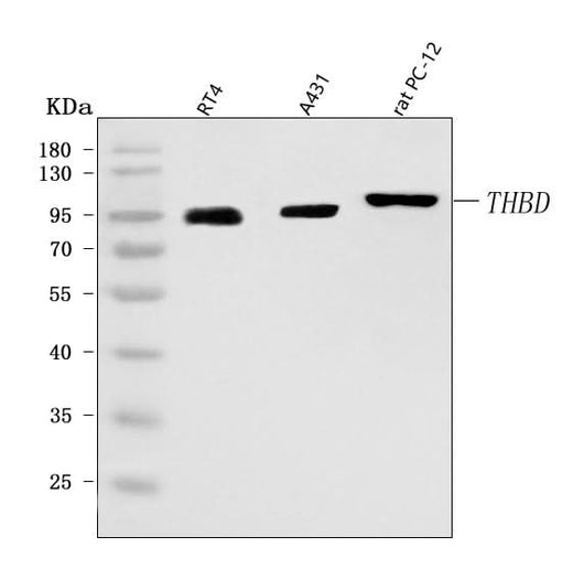 Anti-Thrombomodulin/THBD Antibody Picoband® Boster Bio