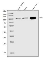 Anti-WFS1 Antibody Picoband® Boster Bio