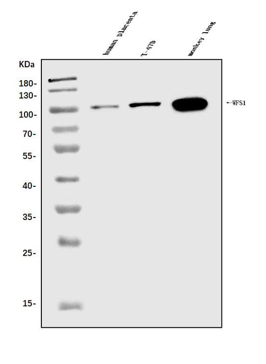 Anti-WFS1 Antibody Picoband® Boster Bio
